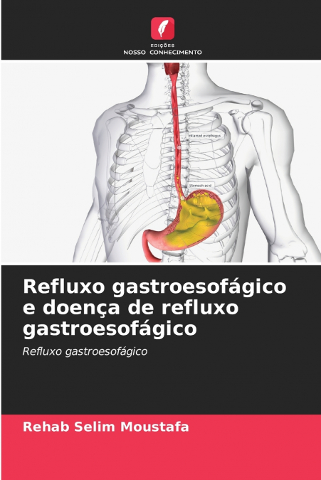 Refluxo gastroesofágico e doença de refluxo gastroesofágico