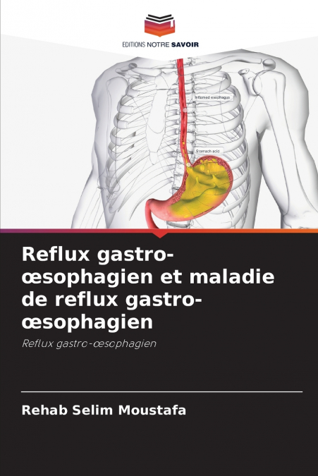 Reflux gastro-œsophagien et maladie de reflux gastro-œsophagien