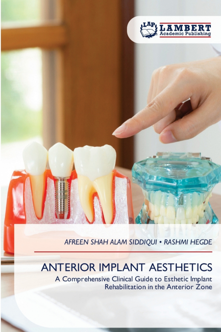 ANTERIOR IMPLANT AESTHETICS