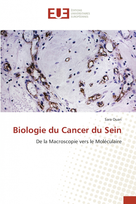 Biologie du Cancer du Sein