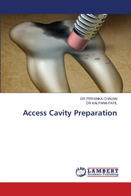 Access Cavity Preparation