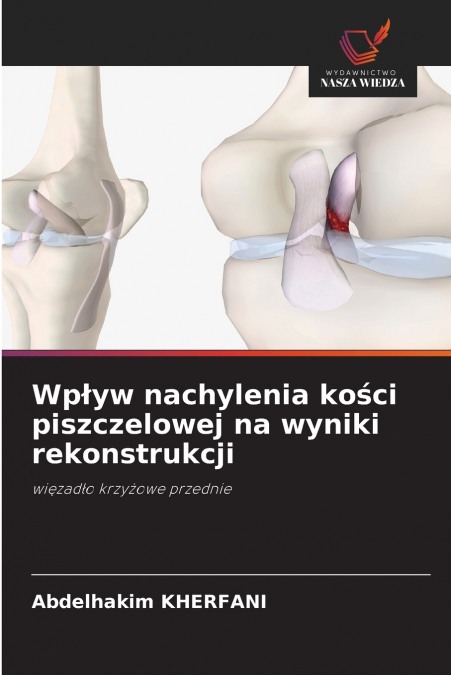 Wpływ nachylenia kości piszczelowej na wyniki rekonstrukcji