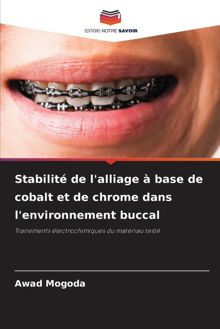 Stabilité de l’alliage à base de cobalt et de chrome dans l’environnement buccal