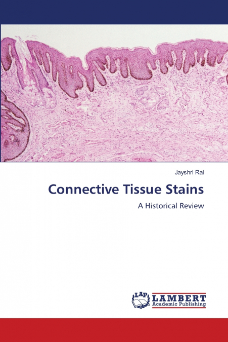 Connective Tissue Stains