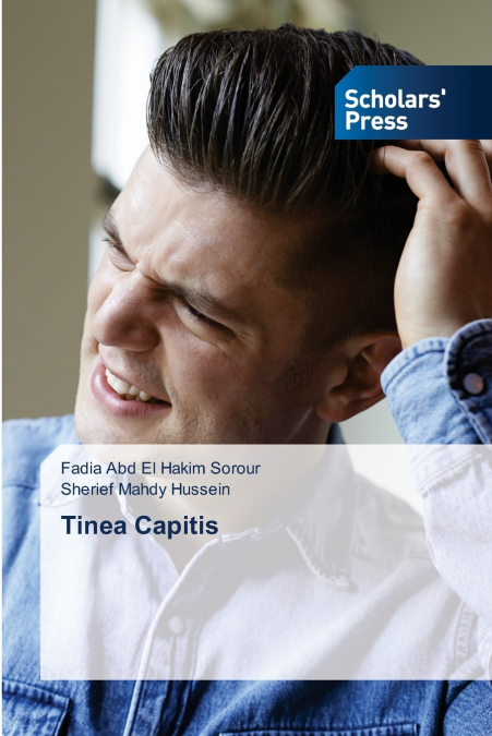 Tinea Capitis
