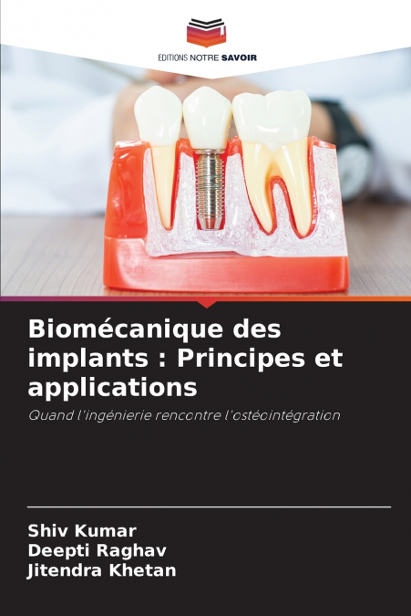 Biomécanique des implants