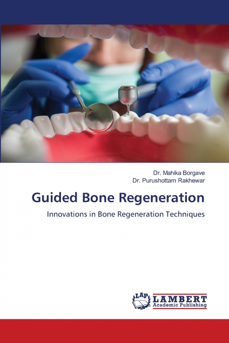 Guided Bone Regeneration