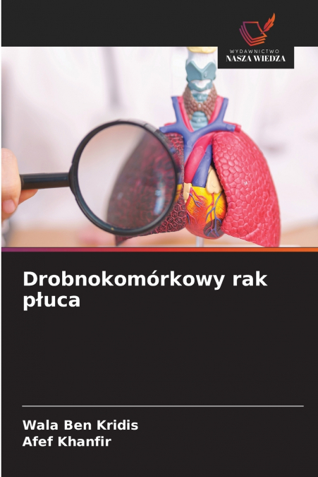 Drobnokomórkowy rak płuca