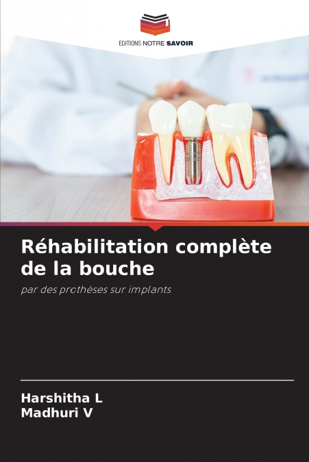 Réhabilitation complète de la bouche