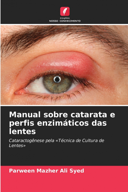 Manual sobre catarata e perfis enzimáticos das lentes