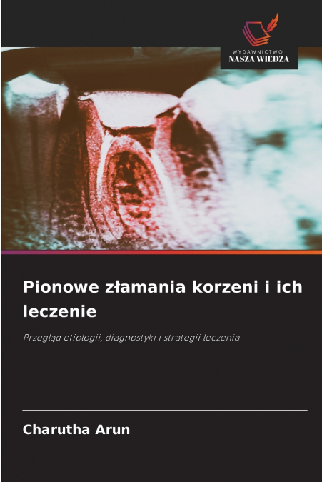 Pionowe złamania korzeni i ich leczenie