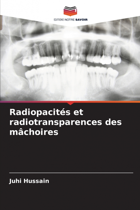 Radiopacités et radiotransparences des mâchoires