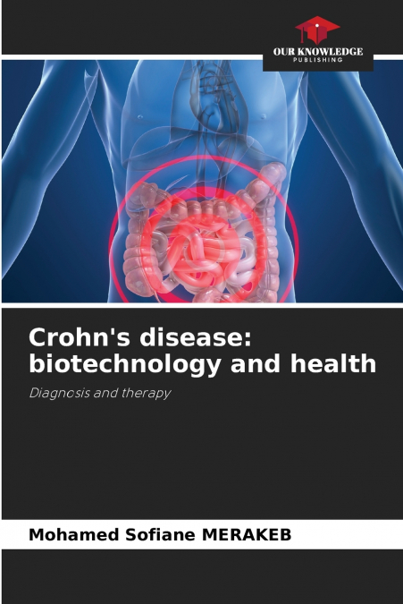 Crohn’s disease
