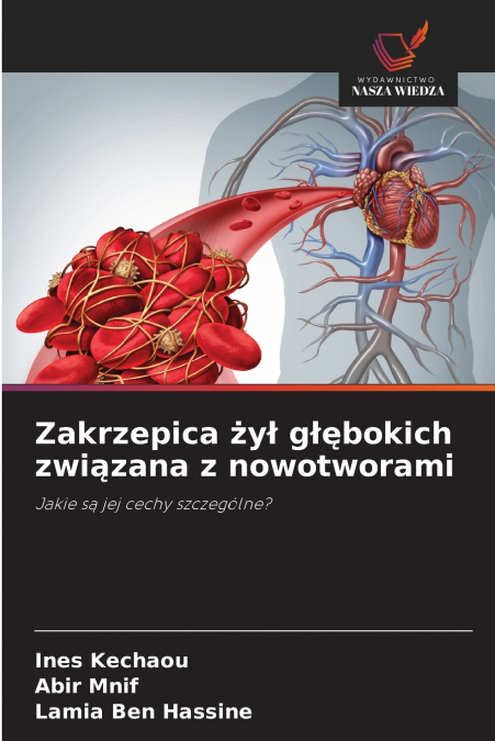 Zakrzepica żył głębokich związana z nowotworami