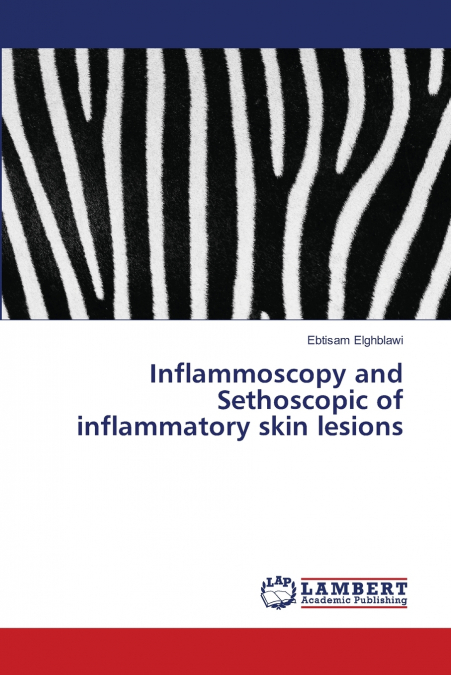Inflammoscopy and Sethoscopic of inflammatory skin lesions