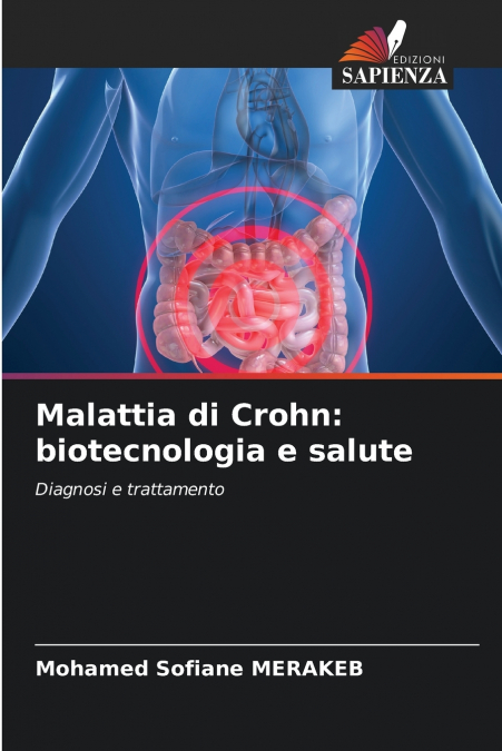 Malattia di Crohn