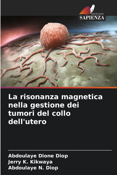 La risonanza magnetica nella gestione dei tumori del collo dell’utero