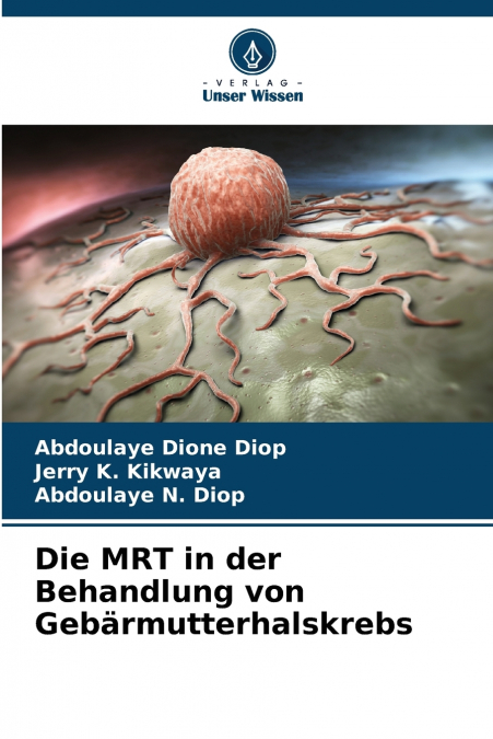 Die MRT in der Behandlung von Gebärmutterhalskrebs