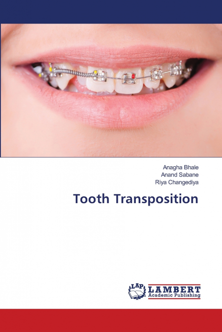 Tooth Transposition