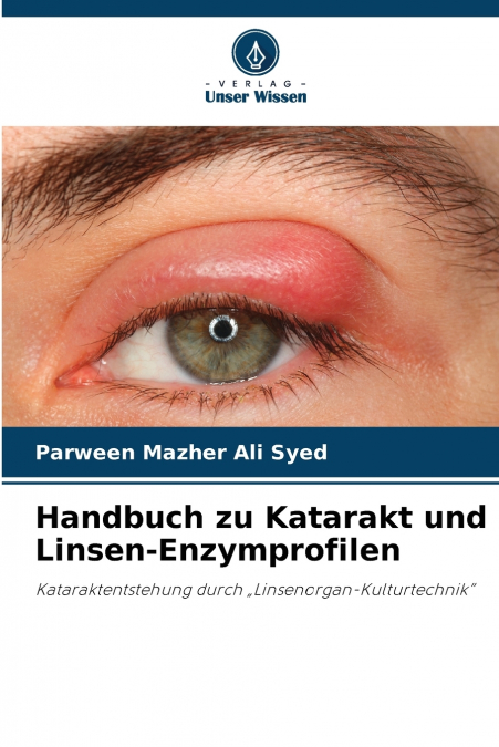 Handbuch zu Katarakt und Linsen-Enzymprofilen