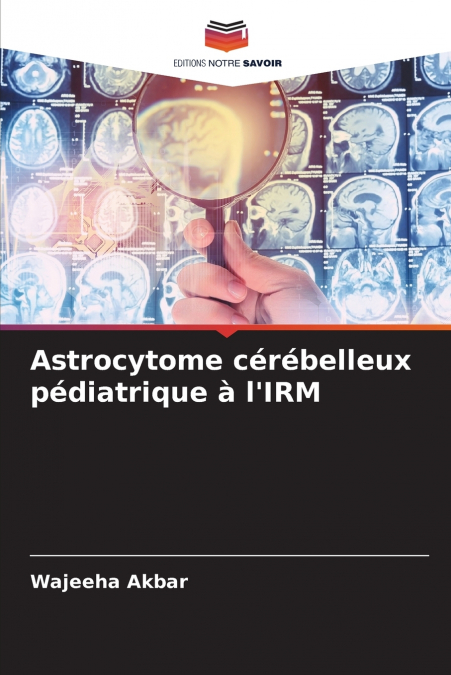 Astrocytome cérébelleux pédiatrique à l’IRM