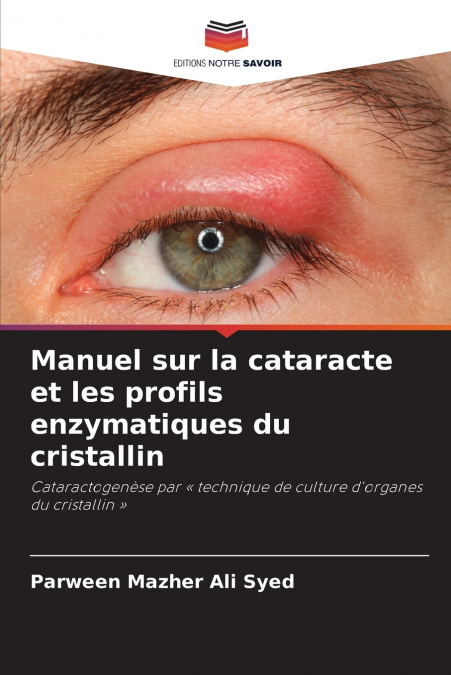 Manuel sur la cataracte et les profils enzymatiques du cristallin