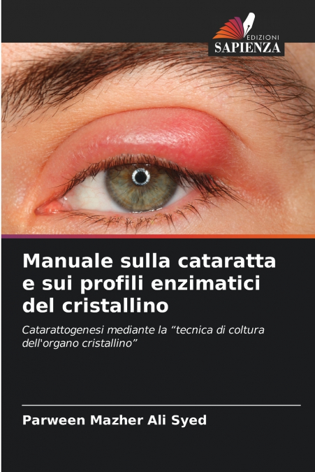 Manuale sulla cataratta e sui profili enzimatici del cristallino