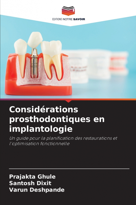 Considérations prosthodontiques en implantologie