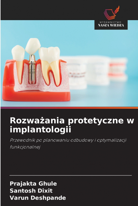 Rozważania protetyczne w implantologii