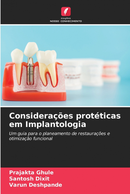 Considerações protéticas em Implantologia