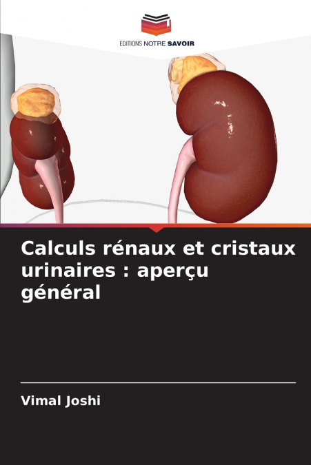 Calculs rénaux et cristaux urinaires