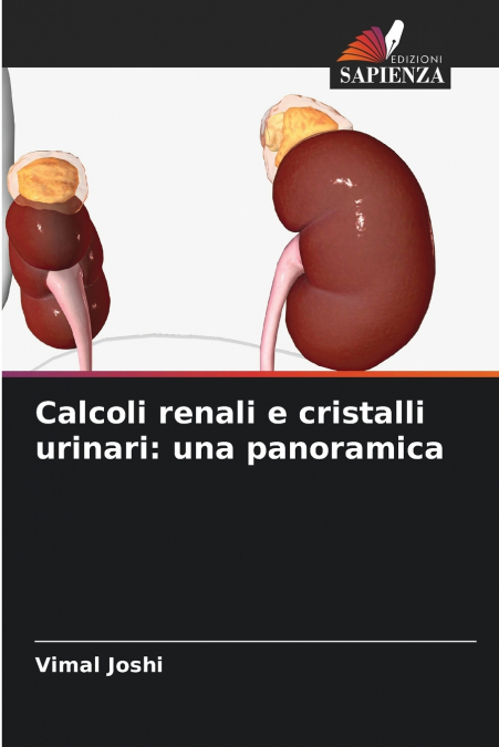 Calcoli renali e cristalli urinari