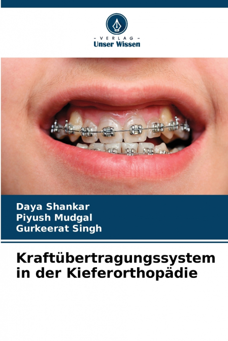 Kraftübertragungssystem in der Kieferorthopädie