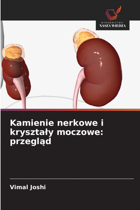 Kamienie nerkowe i kryształy moczowe