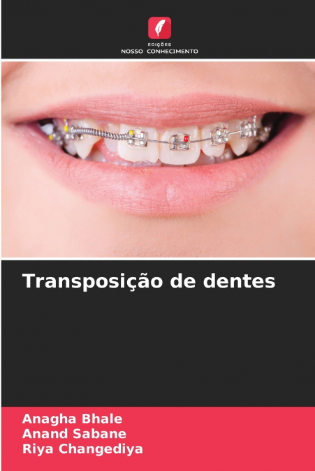 Transposição de dentes