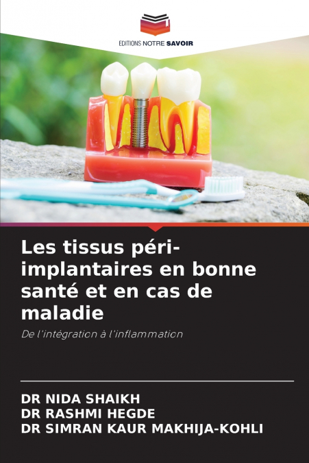 Les tissus péri-implantaires en bonne santé et en cas de maladie