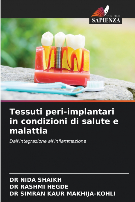 Tessuti peri-implantari in condizioni di salute e malattia