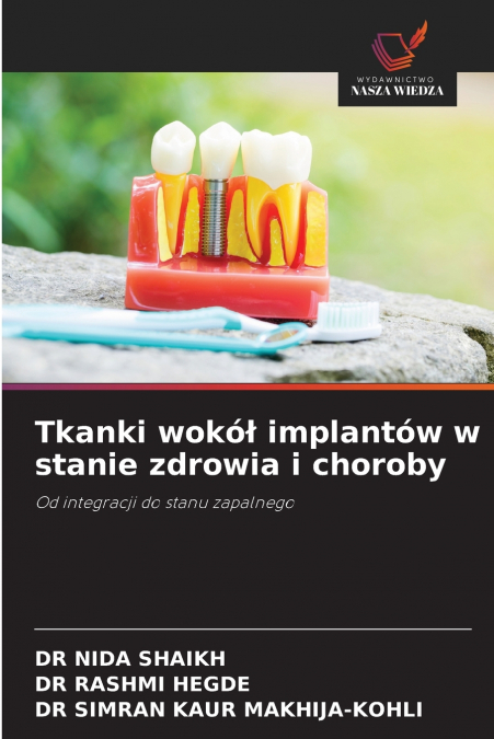 Tkanki wokół implantów w stanie zdrowia i choroby