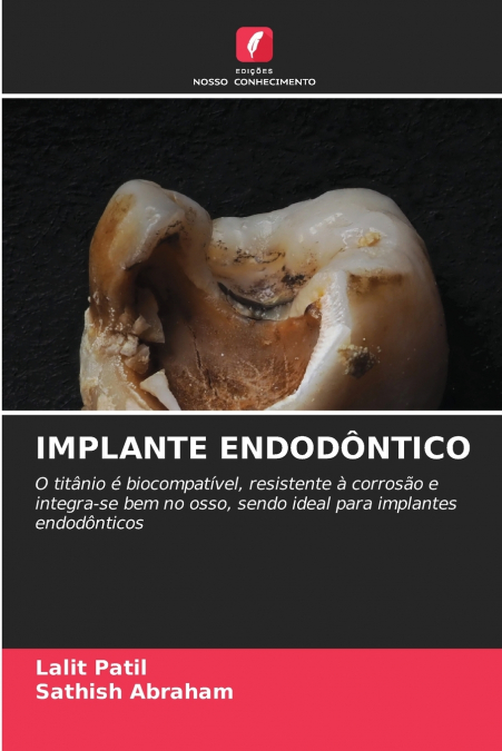 IMPLANTE ENDODÔNTICO