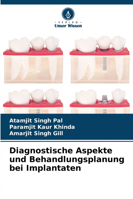 Diagnostische Aspekte und Behandlungsplanung bei Implantaten