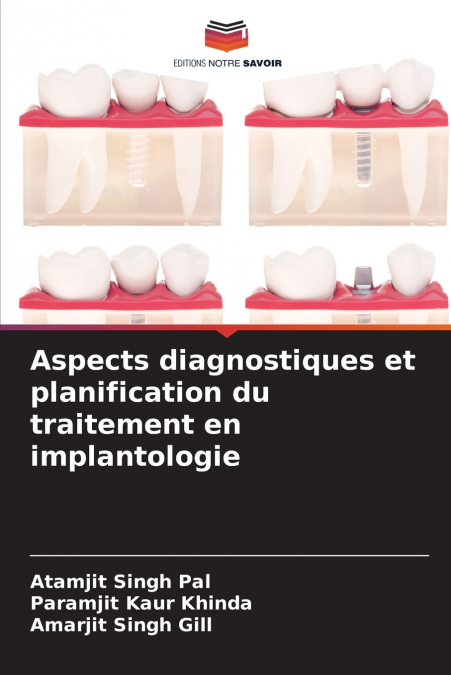 Aspects diagnostiques et planification du traitement en implantologie