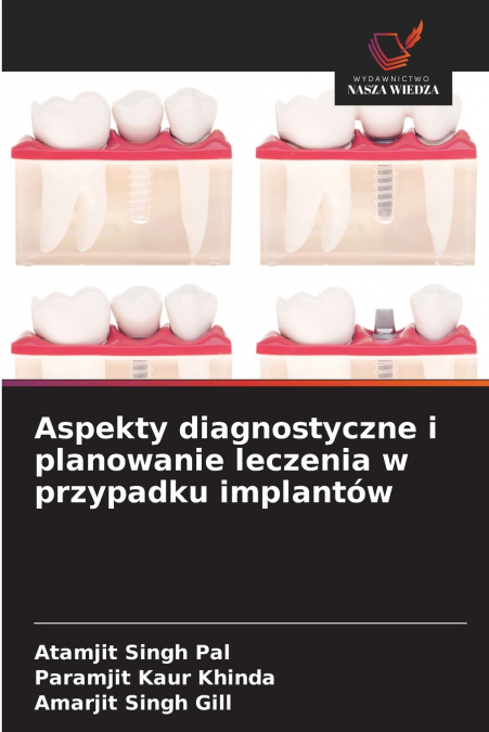 Aspekty diagnostyczne i planowanie leczenia w przypadku implantów