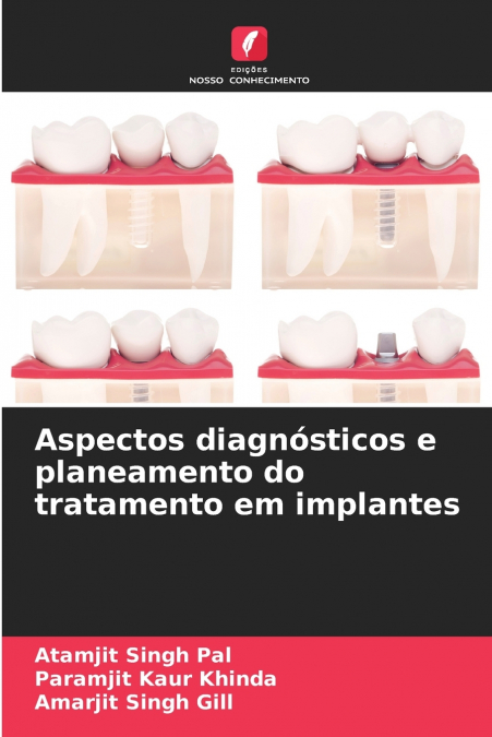 Aspectos diagnósticos e planeamento do tratamento em implantes