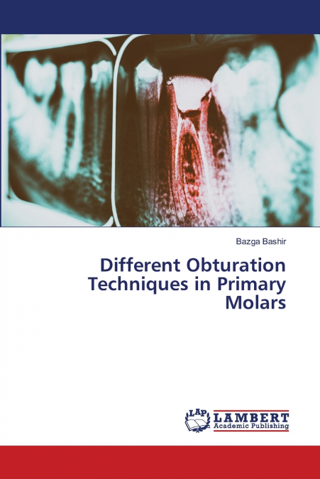 Different Obturation Techniques in Primary Molars