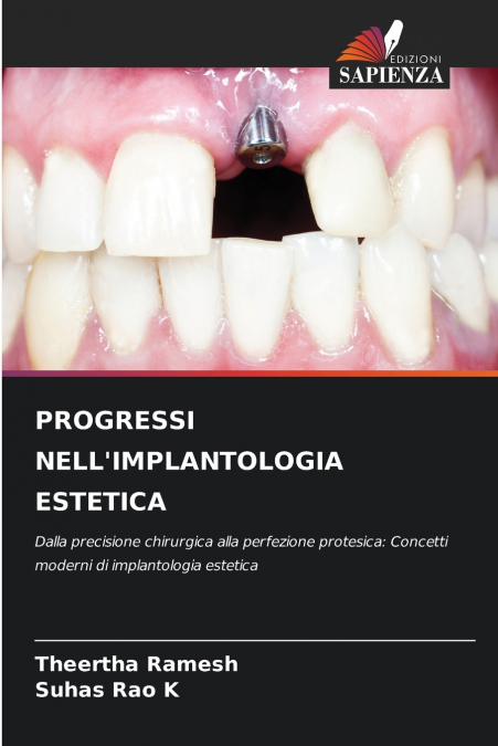 PROGRESSI NELL’IMPLANTOLOGIA ESTETICA