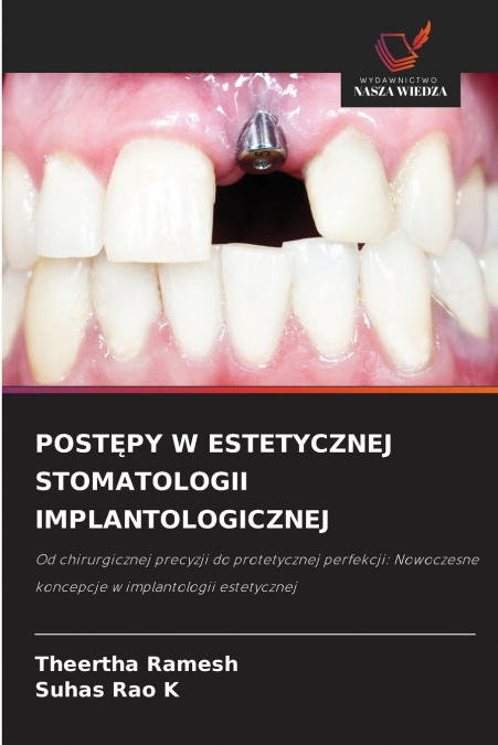 POSTĘPY W ESTETYCZNEJ STOMATOLOGII IMPLANTOLOGICZNEJ