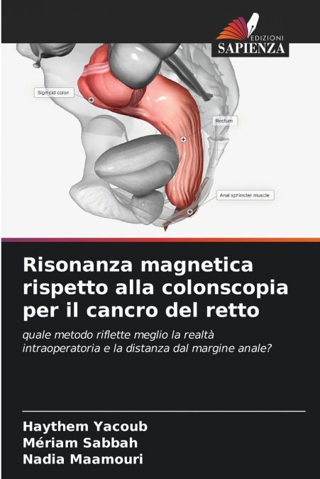Risonanza magnetica rispetto alla colonscopia per il cancro del retto