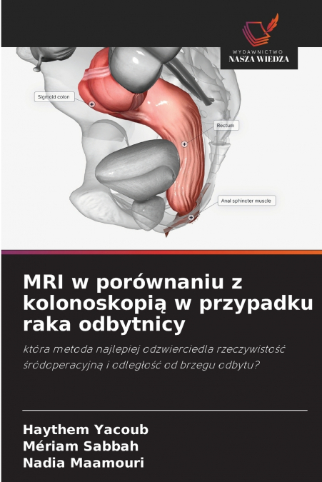 MRI w porównaniu z kolonoskopią w przypadku raka odbytnicy