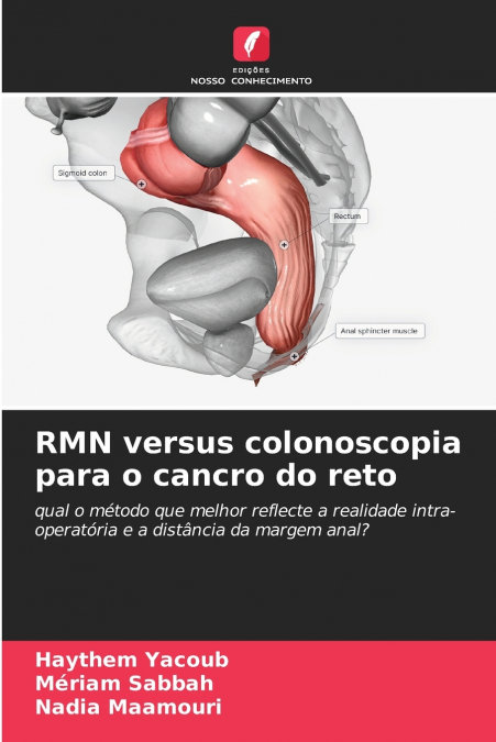 RMN versus colonoscopia para o cancro do reto