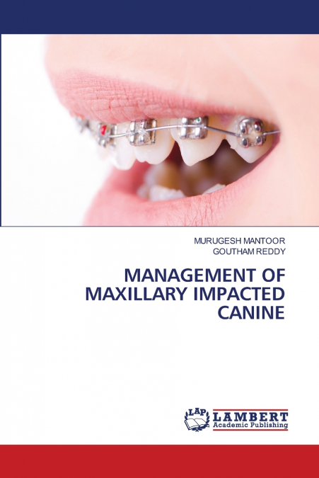 MANAGEMENT OF MAXILLARY IMPACTED CANINE